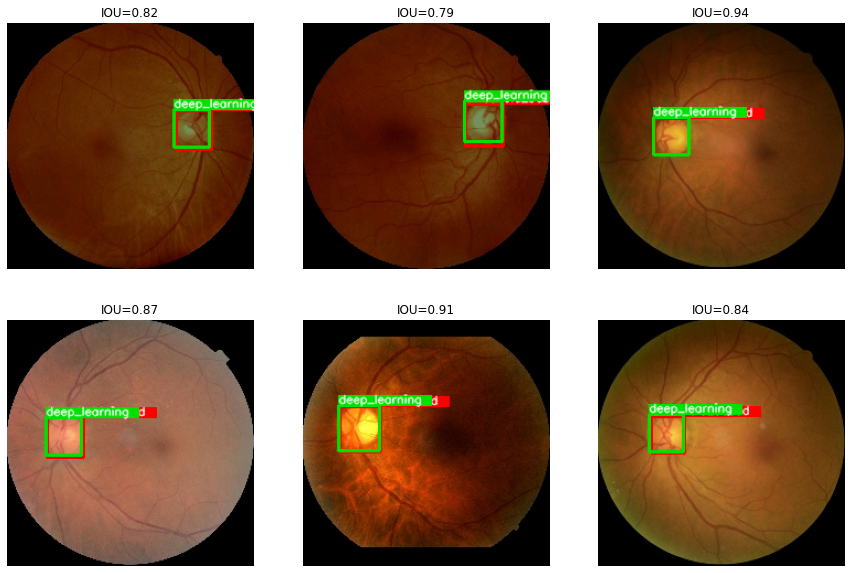 Automatically extracting the optic disc area in fundus images